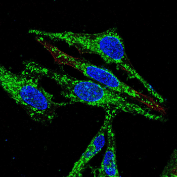 ROCK1 Antibody