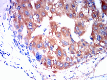 ROCK1 Antibody