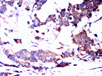 MAP3K3 Antibody