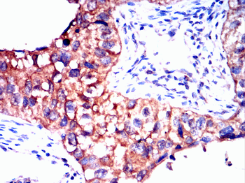 MAP3K3 Antibody