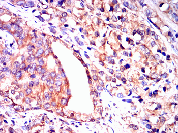 MAP3K3 Antibody