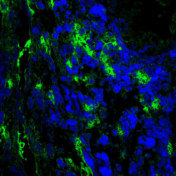 MAP3K3 Antibody