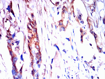 MAP3K3 Antibody