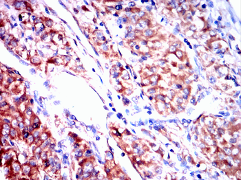 MAP3K3 Antibody