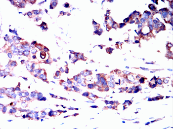 PDIA2 Antibody