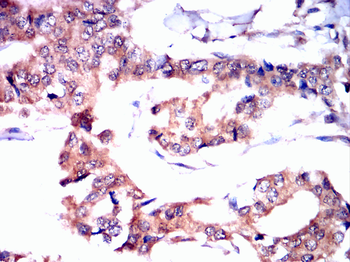 CHUK Antibody