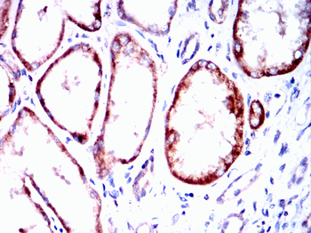 CHUK Antibody