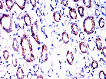 BCL2A1 Antibody