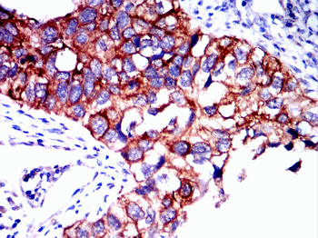 BCL2A1 Antibody