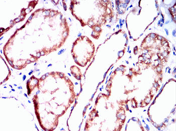 NLRP3 Antibody