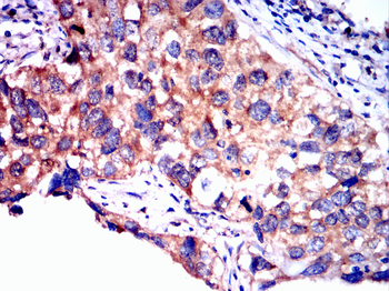 NLRP3 Antibody