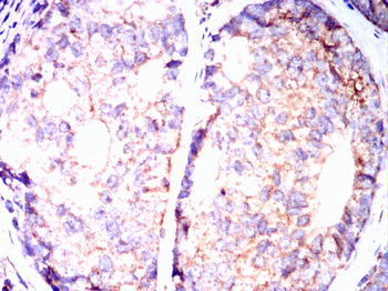 NLRP3 Antibody