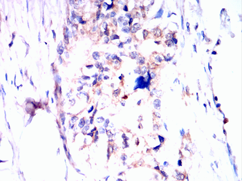 NLRP3 Antibody