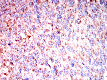 GLI1 Antibody