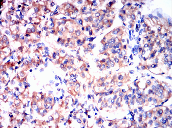 GLI1 Antibody