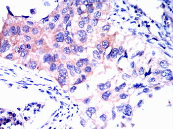 CGB3 Antibody