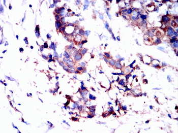 ITGAV Antibody