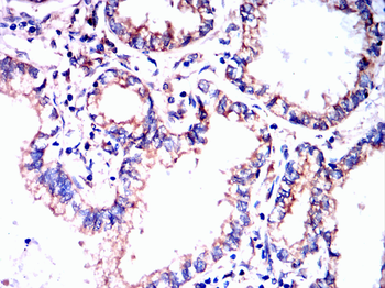 ITGAV Antibody
