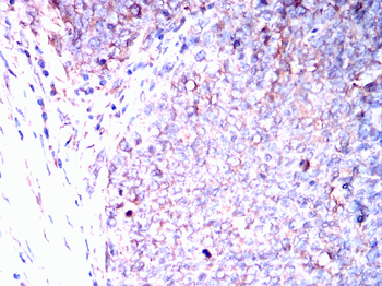ITGAV Antibody