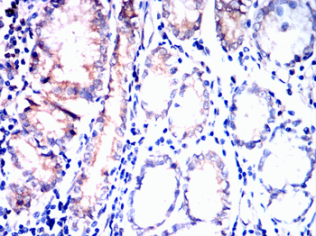 ITGAV Antibody