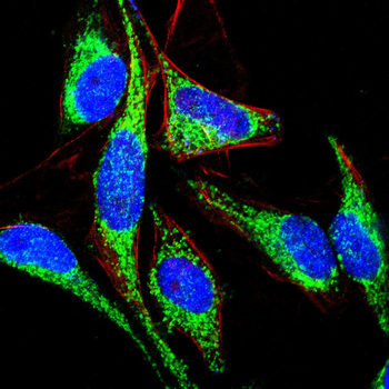 ITGB3 Antibody