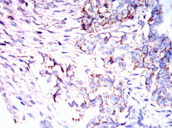 ITGB3 Antibody