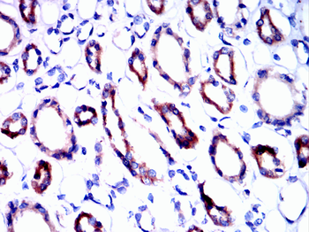 ITGB3 Antibody
