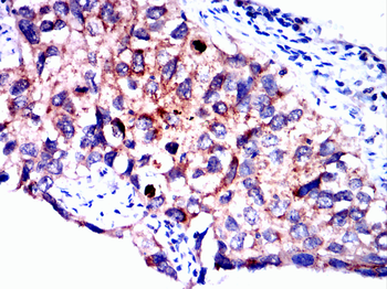 ITGB3 Antibody