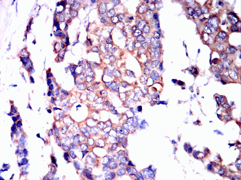 MAP2K1 Antibody