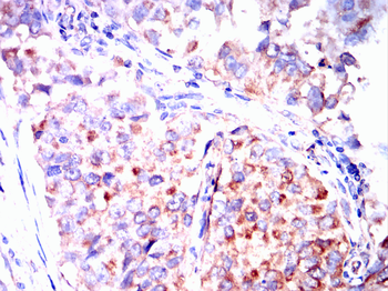 MAP2K1 Antibody