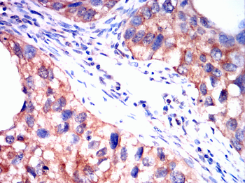 MAP2K1 Antibody