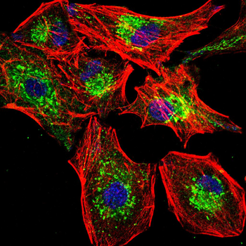 PIM1 Antibody