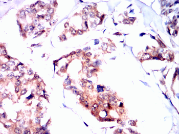 PIM1 Antibody