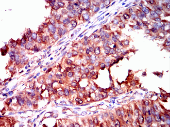 PIM1 Antibody