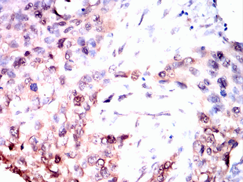 PIM1 Antibody