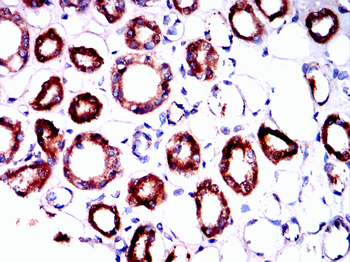 PIM1 Antibody