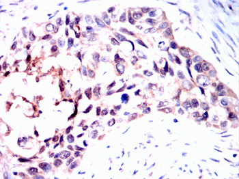PIM1 Antibody