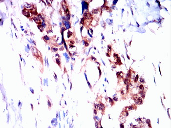 PIM1 Antibody