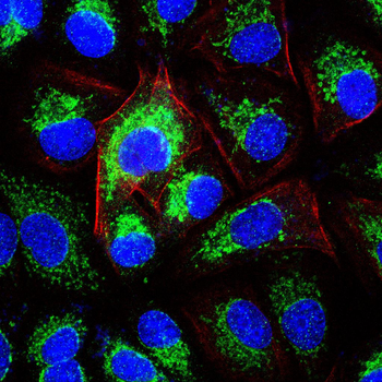 AP2M1 Antibody