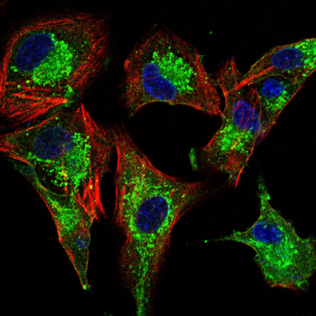 CNP Antibody