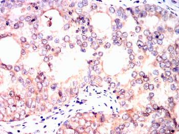 CNP Antibody