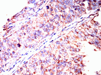 CXCR3 Antibody