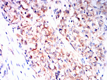 CXCR3 Antibody