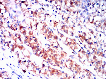 LDHB Antibody
