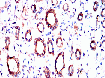 CNN1 Antibody