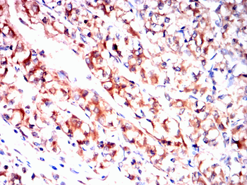 CNN1 Antibody