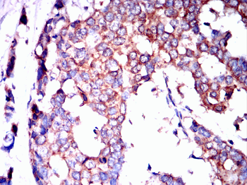 TTR Antibody
