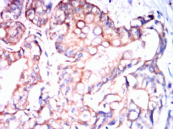 TTR Antibody