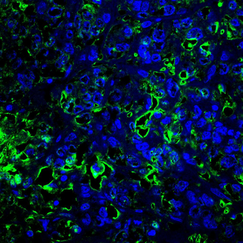 TTR Antibody