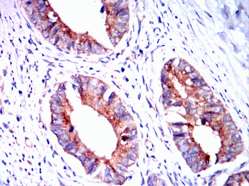TTR Antibody